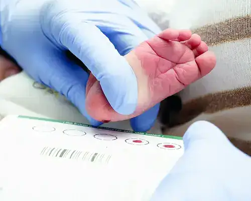 CRIBADO NEONATAL